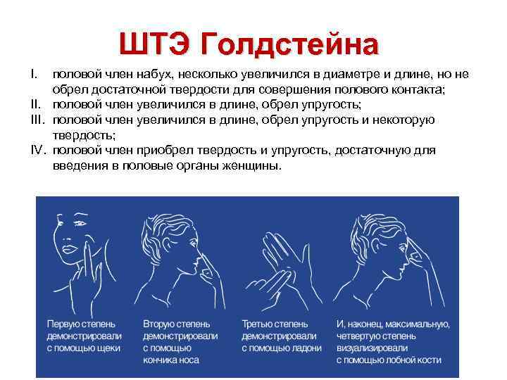 ШТЭ Голдстейна I. половой член набух, несколько увеличился в диаметре и длине, но не