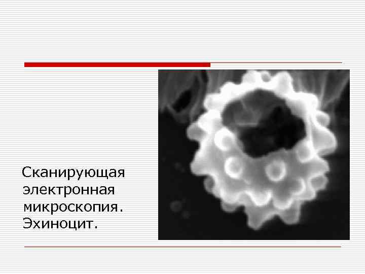 Сканирующая электронная микроскопия. Эхиноцит. Эхиноцит под микроскопом. Снимок сканирующего электронного микроскопа кровь. Сканирующая электронная микроскопия выделение эритроцитов.