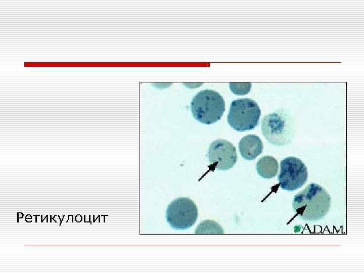 Ретикулоцит 