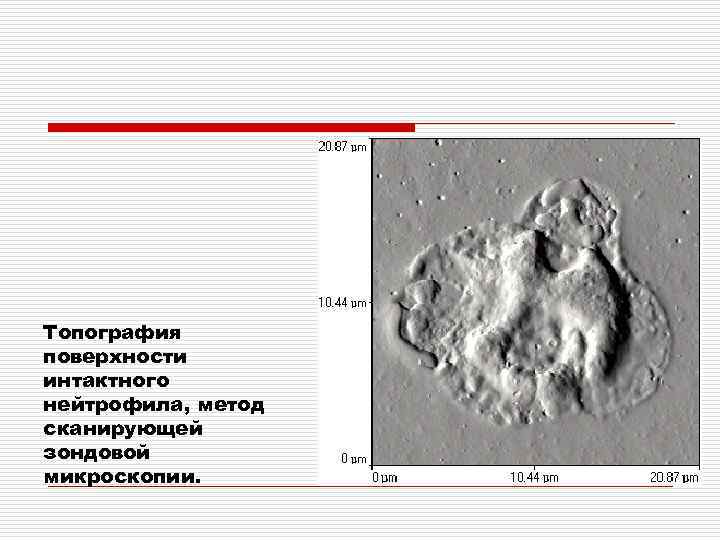 Топография поверхности интактного нейтрофила, метод сканирующей зондовой микроскопии. 