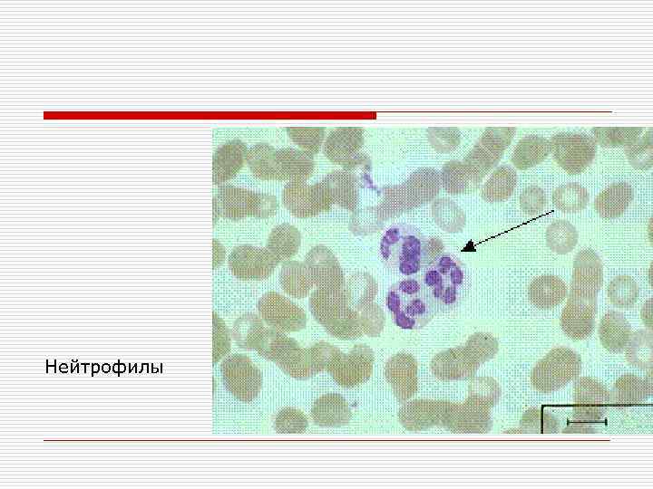 Нейтрофилы 