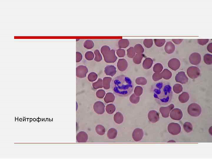 Нейтрофилы 