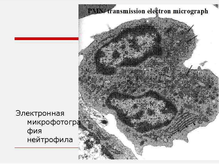 Электронная микрофотогра фия нейтрофила 