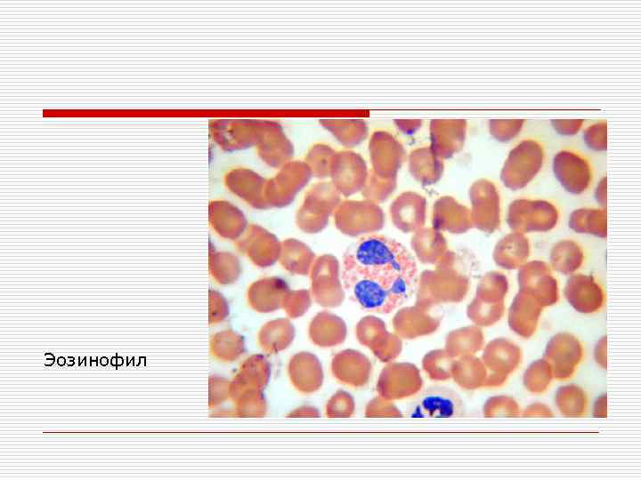 Эозинофил 