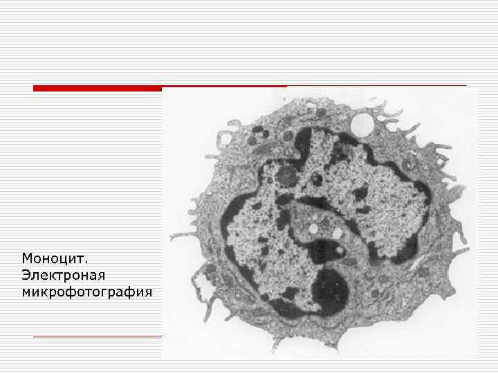 Моноцит. Электроная микрофотография 