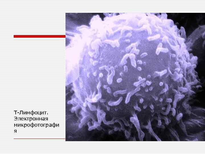 Т-Лимфоцит. Электронная микрофотографи я 