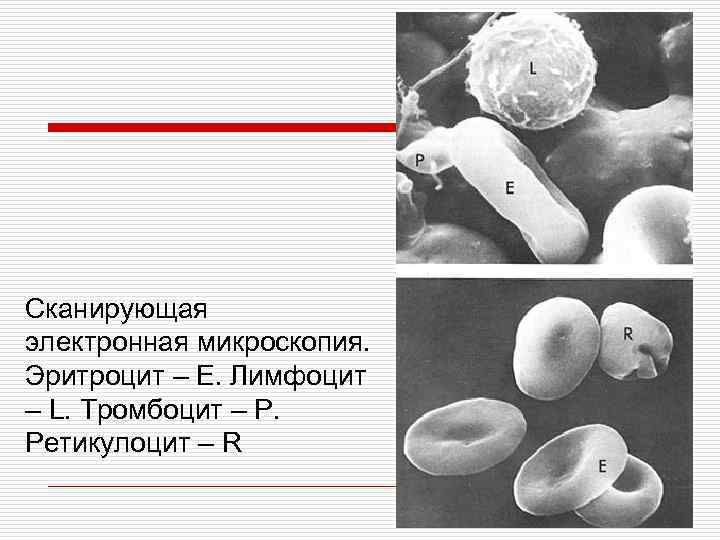 Сканирующая электронная микроскопия