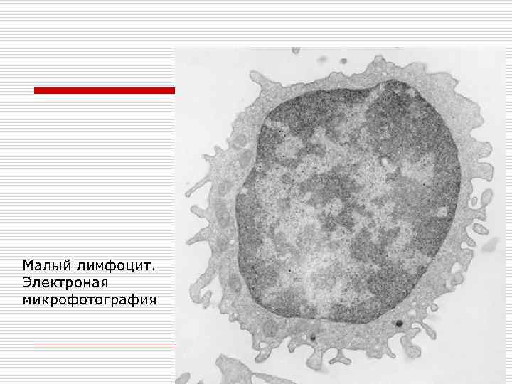 Малый лимфоцит. Электроная микрофотография 