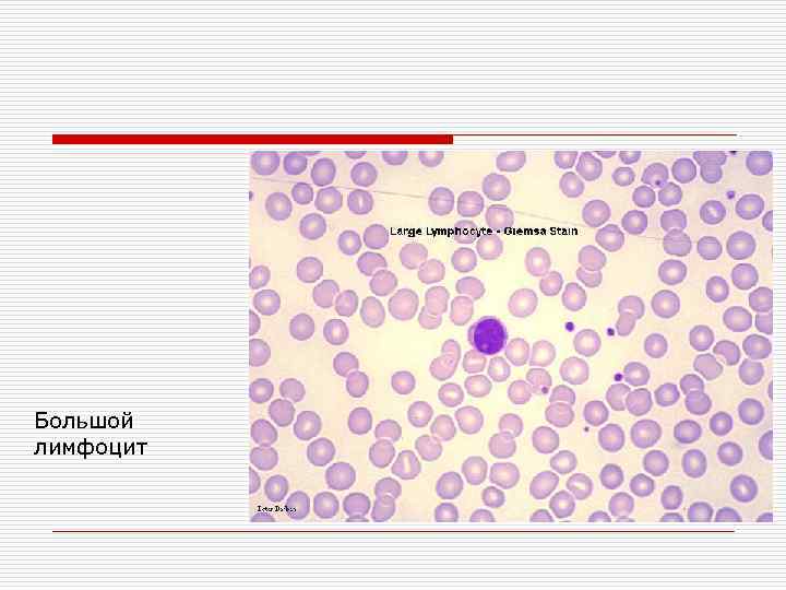 Большой лимфоцит 