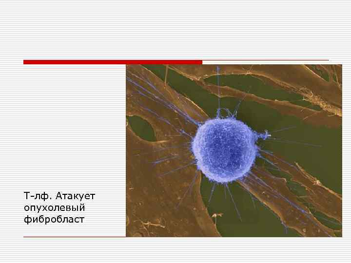 Т-лф. Атакует опухолевый фибробласт 