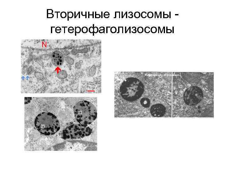Вторичные лизосомы гетерофаголизосомы 