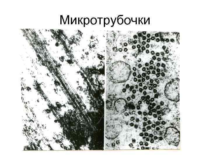 Микротрубочки 