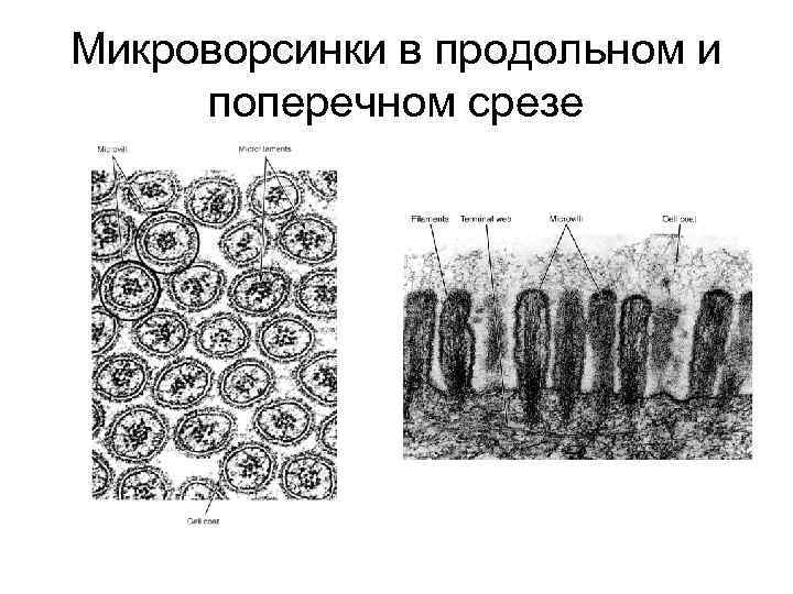 Микроворсинки в продольном и поперечном срезе 