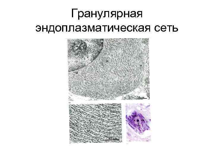 Гранулярная эндоплазматическая сеть 