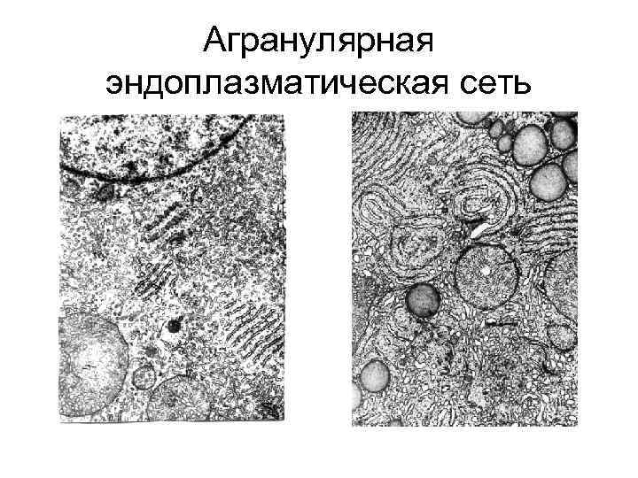 Агранулярная эндоплазматическая сеть 