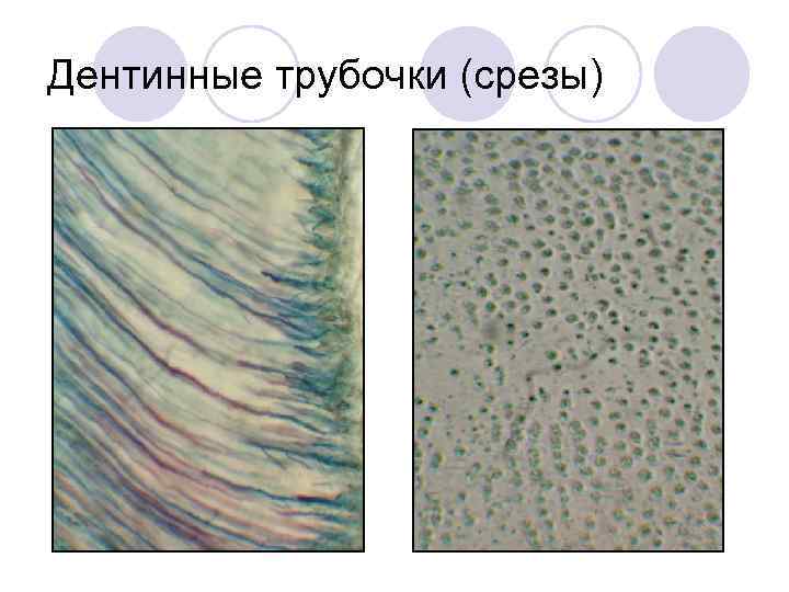 Дентинные трубочки (срезы) 