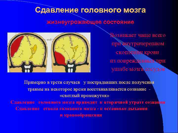 Сдавление головного мозга жизнеугрожающее состояние Возникает чаще всего при внутричерепном скоплении крови из поврежденных