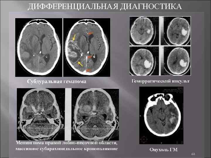 ДИФФЕРЕНЦИАЛЬНАЯ ДИАГНОСТИКА 
