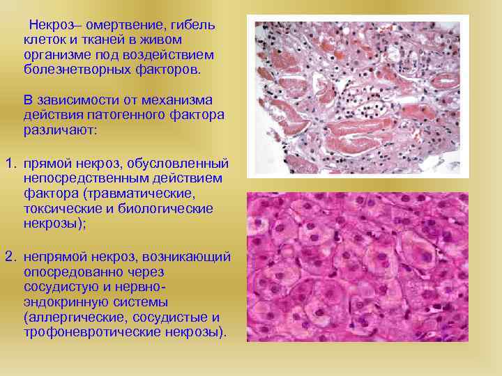  Некроз– омертвение, гибель клеток и тканей в живом организме под воздействием болезнетворных факторов.