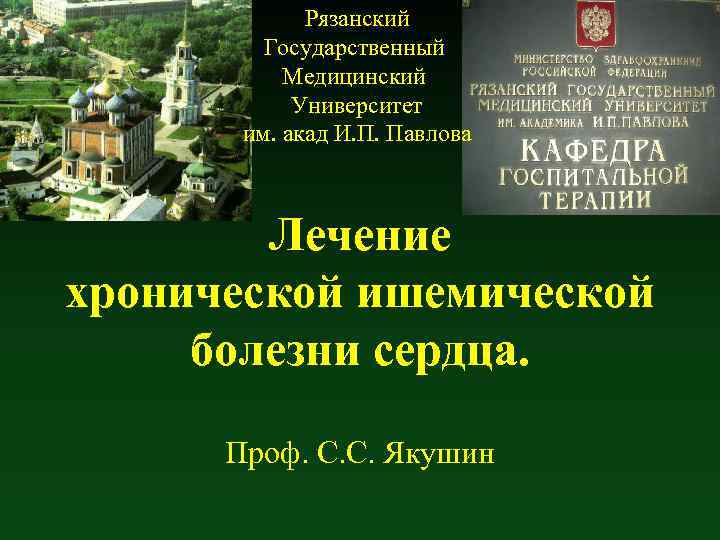 Рязанский Государственный Медицинский Университет им. акад И. П. Павлова Лечение хронической ишемической болезни сердца.