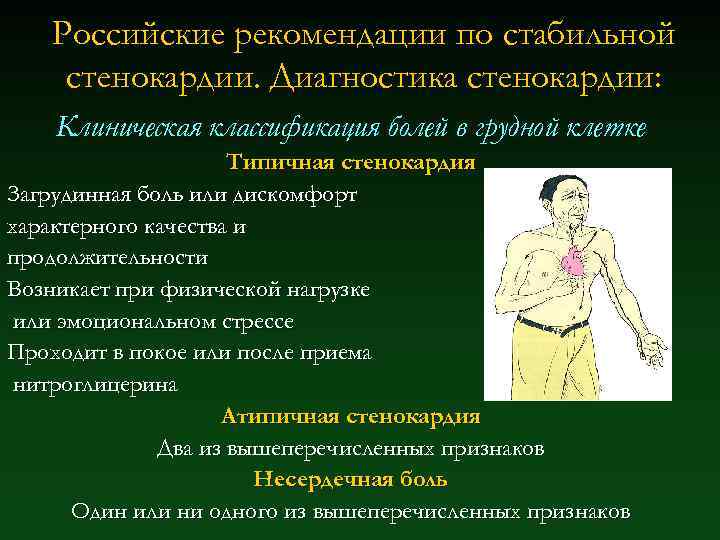 Российские рекомендации по стабильной стенокардии. Диагностика стенокардии: Клиническая классификация болей в грудной клетке Типичная
