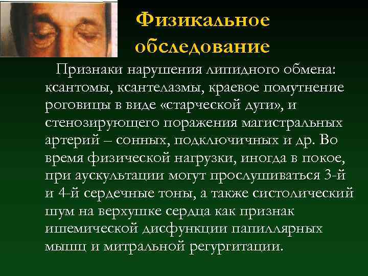 Физикальное обследование Признаки нарушения липидного обмена: ксантомы, ксантелазмы, краевое помутнение роговицы в виде «старческой