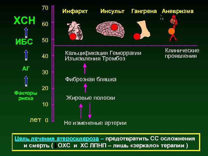 70 ХСН ИБС Инсульт Гангрена Аневризма 60 50 40 АГ Инфаркт Кальцификация Геморрагии Изъязвления