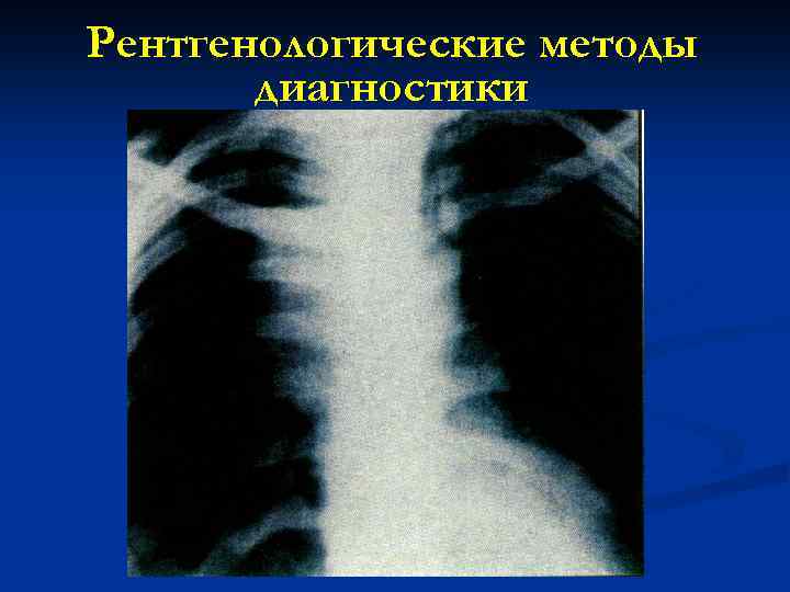 Рентгенологические методы диагностики 