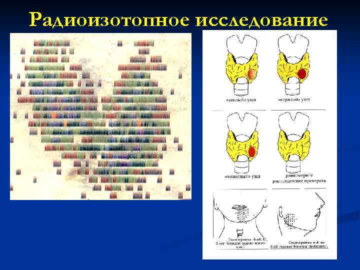 Радиоизотопное исследование 