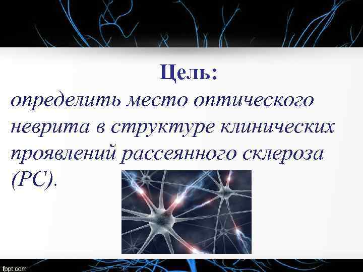 Цель: определить место оптического неврита в структуре клинических проявлений рассеянного склероза (РС). 