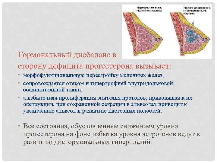 Гормональный дисбаланс в сторону дефицита прогестерона вызывает: • морфофункциональную перестройку молочных желез, • сопровождается