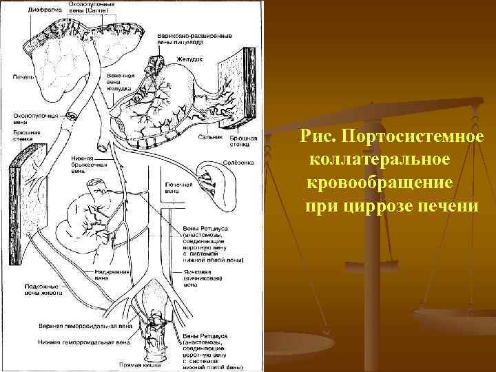 Схема коллатерального кровообращения с обозначениями