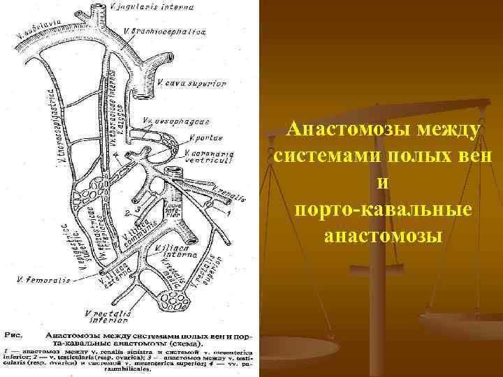 Анастомозы между системами полых вен и порто кавальные анастомозы 