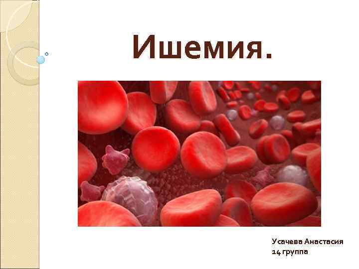 Ишемия. Усачева Анастасия 14 группа 