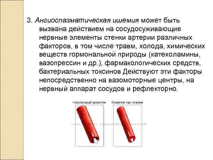  3. Ангиоспазматическая ишемия может быть вызвана действием на сосудосуживающие нервные элементы стенки артерии