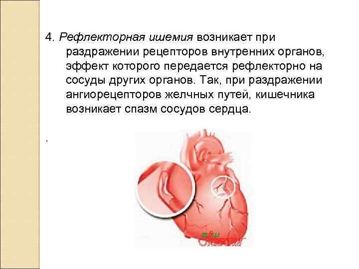  4. Рефлекторная ишемия возникает при раздражении рецепторов внутренних органов, эффект которого передается рефлекторно