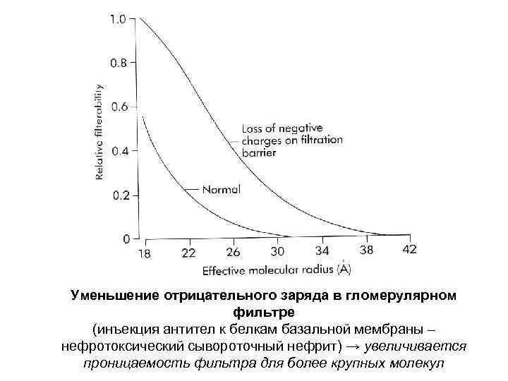 Уменьшение отрицательного заряда в гломерулярном фильтре (инъекция антител к белкам базальной мембраны – нефротоксический