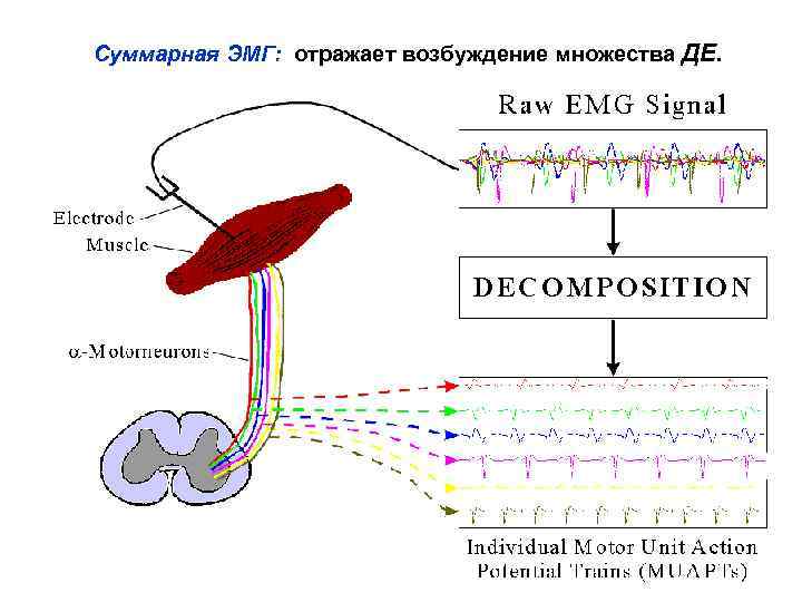 Суммарная ЭМГ: отражает возбуждение множества ДЕ. 