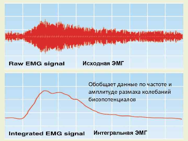 Исходная ЭМГ Обобщает данные по частоте и амплитуде размаха колебаний биоэпотенциалов Интегральная ЭМГ Copyright