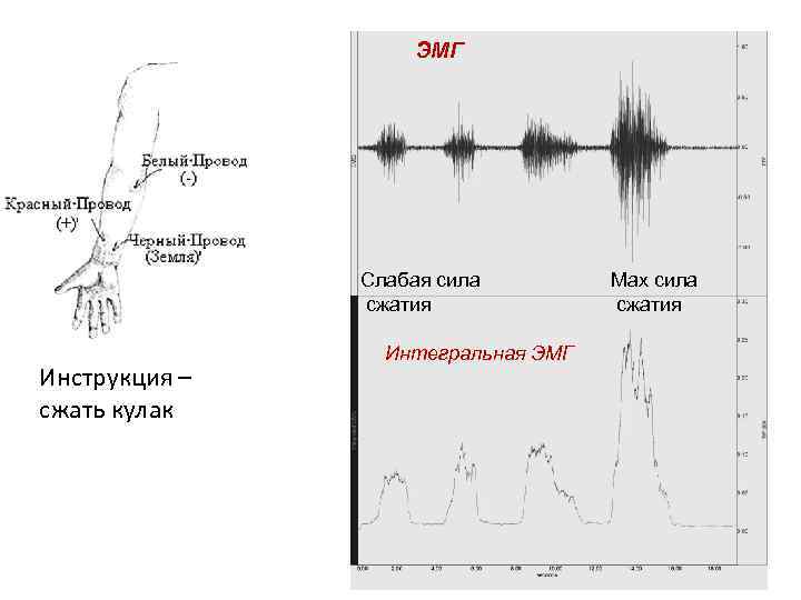 ЭМГ Слабая сила сжатия Инструкция – сжать кулак Интегральная ЭМГ Мах сила сжатия 