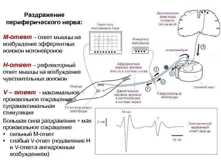 Раздражение периферического нерва: М-ответ – ответ мышцы на возбуждение эфферентных волокон мотонейронов Н-ответ –