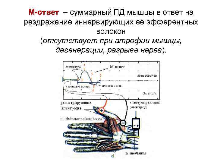 М-ответ – суммарный ПД мышцы в ответ на раздражение иннервирующих ее эфферентных волокон (отсутствует