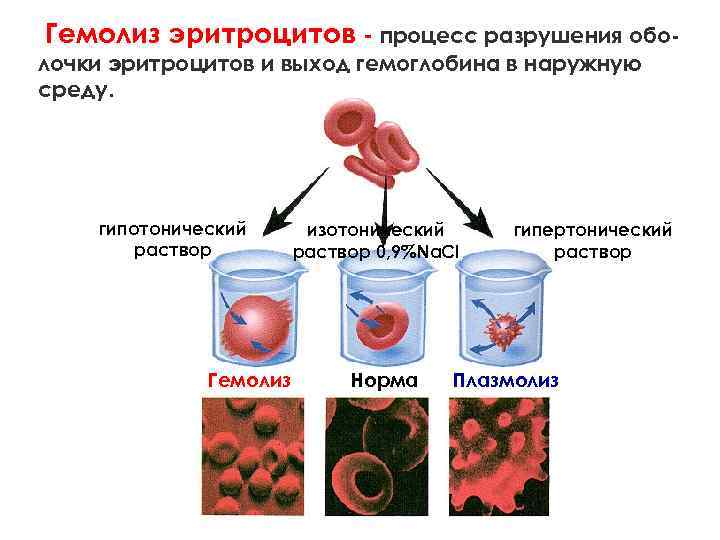 Гемолиз эритроцитов - процесс разрушения обо- лочки эритроцитов и выход гемоглобина в наружную среду.