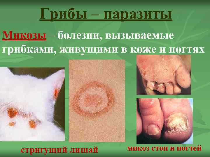 Грибы – паразиты Микозы – болезни, вызываемые грибками, живущими в коже и ногтях стригущий