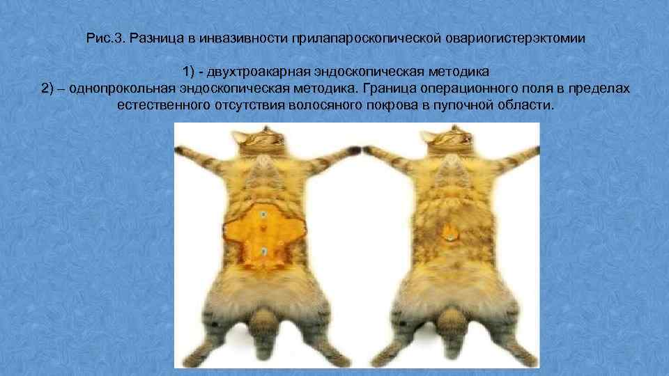 Рис. 3. Разница в инвазивности прилапароскопической овариогистерэктомии 1) - двухтроакарная эндоскопическая методика 2) –