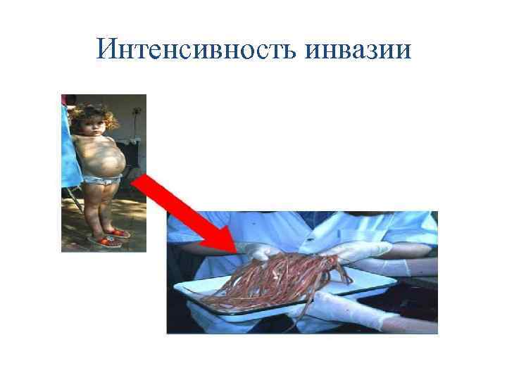 Интенсивность инвазии 