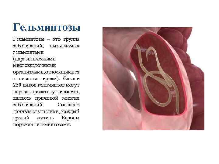 Гельминтозы – это группа заболеваний, вызываемых гельминтами (паразитическими многоклеточными организмами, тносящимися о к низшим