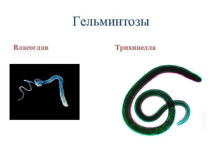 Гельминтозы Власоглав Трихинелла 