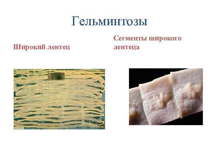 Гельминтозы Широкий лентец Сегменты широкого лентеца 