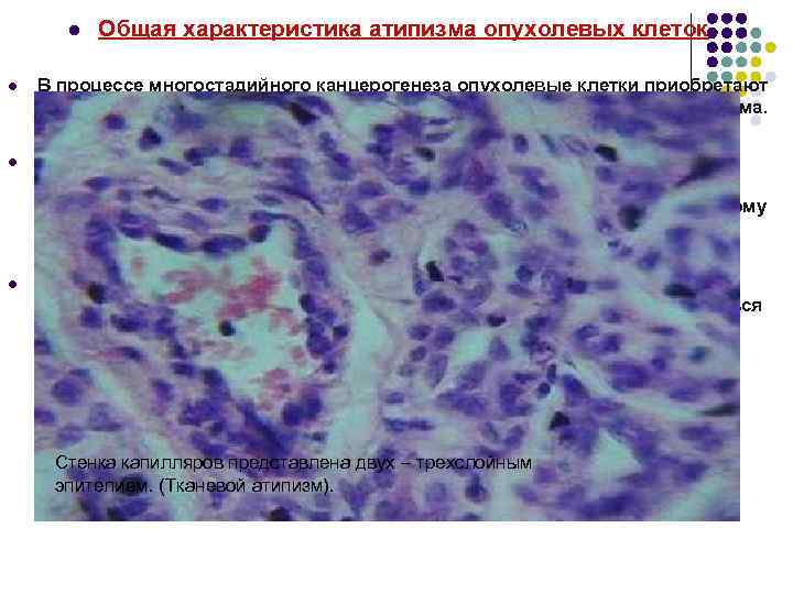 l Общая характеристика атипизма опухолевых клеток l В процессе многостадийного канцерогенеза опухолевые клетки приобретают